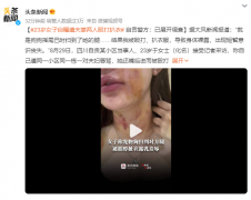 23岁女子自曝遭夫妻两人殴打扒衣：“我被殴打、